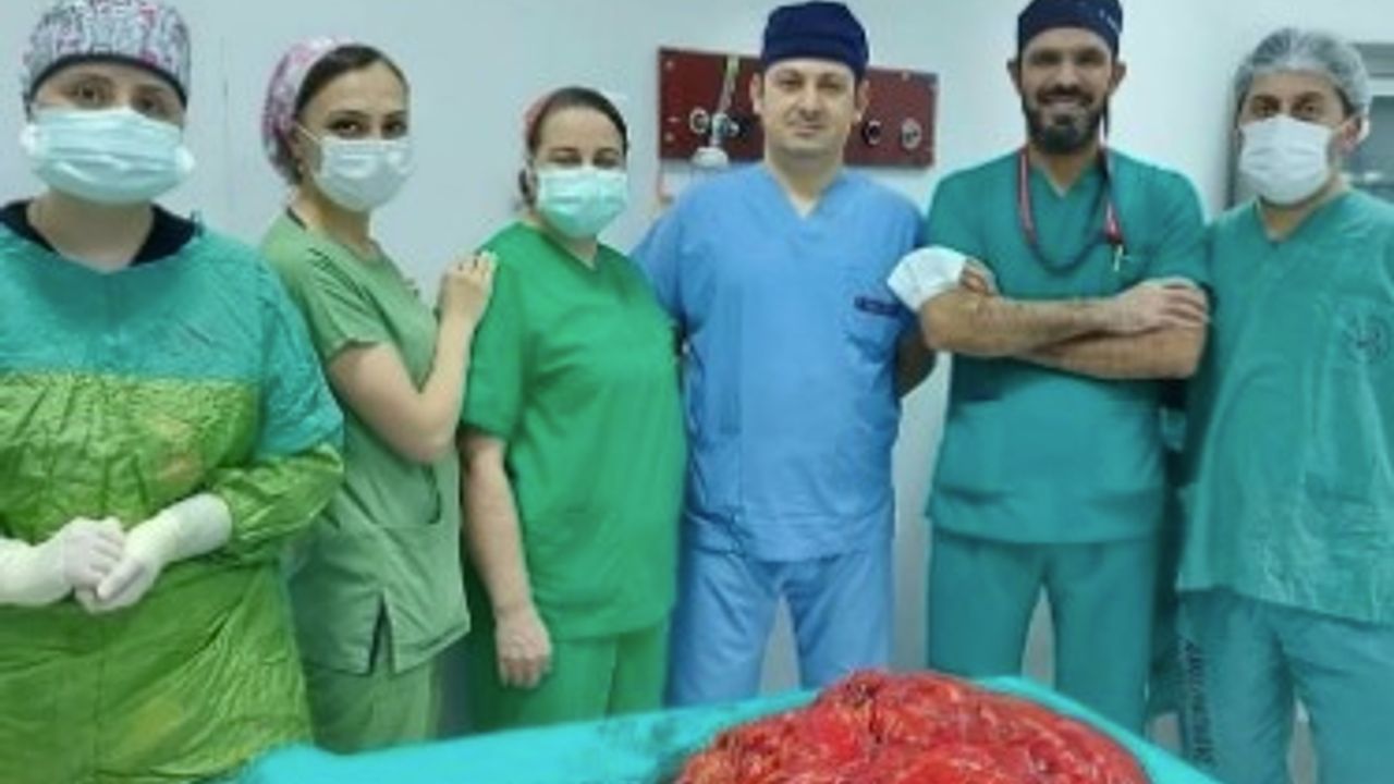 Trabzon'da hastanın karnından 21 kilo tümör çıktı