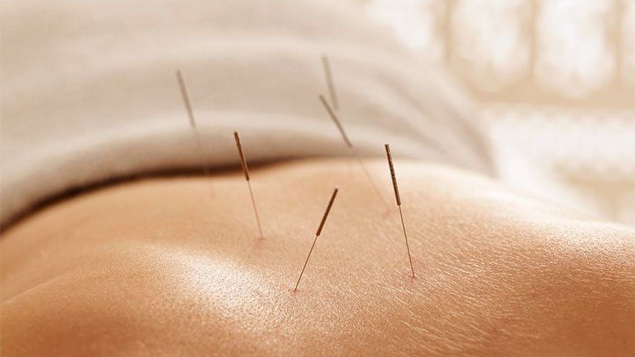 Akupunktur tedavisi cinsel isteği artırır mı?