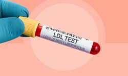 LDL Kolesterol Nedir ve Neden Takip Edilmelidir?