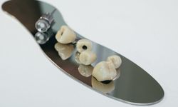 Zirkonyum Dişlerin Diğer Diş Protezlerinden Farkı Nedir?