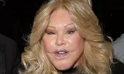 “Kedi Kadın” Jocelyn Wildenstein Hayata Veda Etti