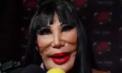 Bir Dönemin Efsanevi Yıldızıydı, Estetik Kabusu Yaşadı!