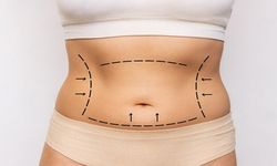 Abdominoplasti Rehberi: Ameliyat Öncesi ve Sonrası Bilinmesi Gerekenler