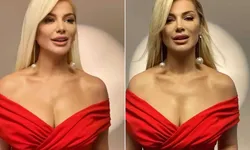 Songül Karlı’nın Yeni Pozu Estetik Tartışmasını Alevlendirdi