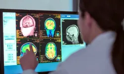 Beyin Yaşam Boyunca Beş Büyük Evrim Aşaması Geçiriyor