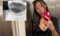 Kadıköy’de Gözde Yılmaz Üzerine Benzin Dökülüp Yakıldı