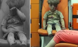 Dünya Gündemine Oturan Ümran Bebeğin Son Hali