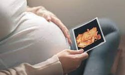 Ayrıntılı Renkli Ultrason ile Bebeğin Gelişimi Yakından İzleniyor