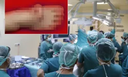 Kulağını Ayağında 5 Ay Beslediler: Mucize Ameliyat