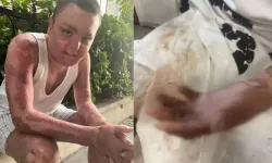 Kağıthane’de Kuaförde Çaydanlık Patladı: Çocuk Yaralandı