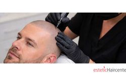 Bursa Saç Simülasyonu ile Doğal Görünüme Ulaş