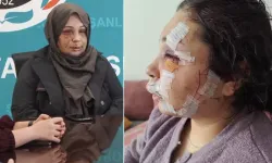 Eşine Şiddet Uygulayan Koruma Polisi Tutuklandı