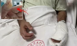 Sıcak Su Torbası Patladı, Vücudunun Yüzde 30’u Yandı