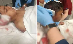 Altındağ’da Sokak Köpeği Saldırısı: 8 Yaşındaki Davut Yaralı