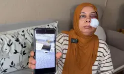 İskenderun’da Kırık Rögar Kazası