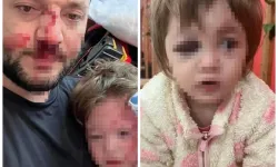 Çınarcık’ta Komşu Saldırısı Baba Ve Bebek Yaralı