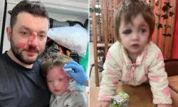 Yalova'da Skuterli Saldırıya 36 Yıla Kadar Hapis