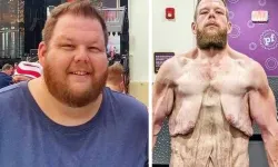 163 Kilo Verdi Ama Çilesi Bitmiyor