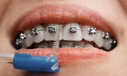 İstanbul Ağız ve Diş Sağlığı Tedavilerinde Nasıl Lider Konuma Geldi?