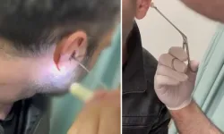 Kayseri’de Şüphelinin Kulağında Yasaklı Madde Bulundu