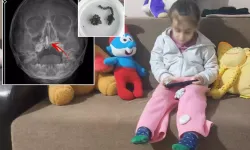 Rize’de Çocuğun Burnundan Metal Parça Çıkarıldı