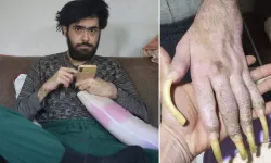 Deprem Sonrası Zor Günler Geçiren Barışa Sürpriz