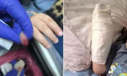 Mardin’de AVM’de Çocuğun Parmağı Koptu