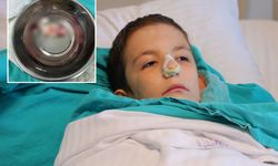 Çocuğun Ağzından Dev Polip Çıkarıldı