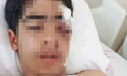 Esenyurt’ta Akran Zorbalığı Çocuğu Yaraladı