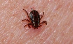 Kene Vakası Sonrası Genç Yaşamını Yitirdi