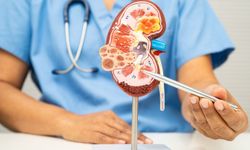 Türkiye'de Üroloji: Kapsamlı Bir Rehber