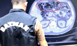 Batman'da Şüpheli Yolcunun Midesinden Yasaklı Madde Çıktı