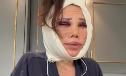 Didem Ceran Eleştirilere Ameliyat Sonrası Yanıt Verdi