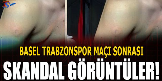 Basel'de Trabzonspor Taraftarına Plastik Mermi Sıktılar!