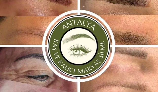 Antalya’da Profesyonel Microblading Silme İşlemleri