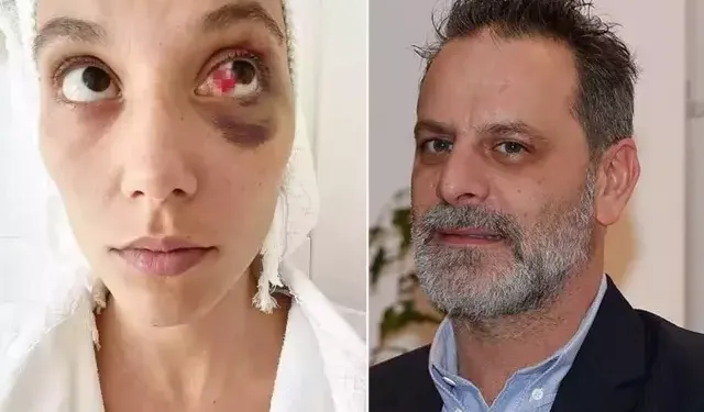 Ozan Güven’e 2 Yıl 3 Ay Hapis Cezası: “Yargı Süreci Devam Ediyor”