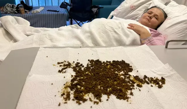 Soma’da 70 Yaşındaki Kadının Safra Taşı 20 Bin