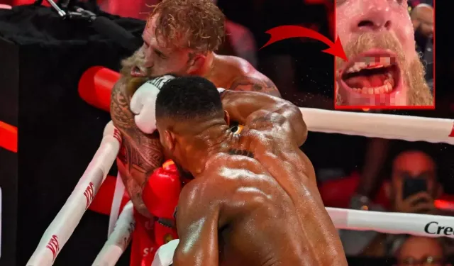Anthony Joshua, Jake Paul’u Nakavt Etti: Çenesi Kırıldı