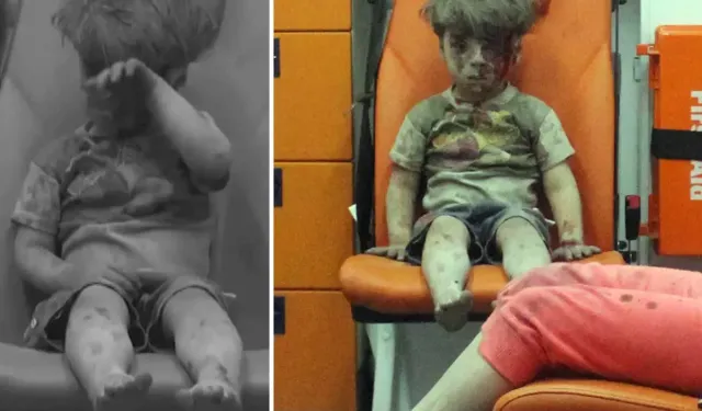 Dünya Gündemine Oturan Ümran Bebeğin Son Hali