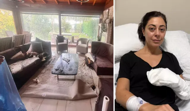 Dekoratif Şömine Patladı: 41 Yaşındaki Kadın Ağır Yaralı