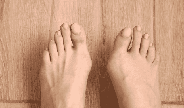 Halluks Valgus Gece Ateli: Gerçekten İşe Yarıyor mu, Yoksa Vakit Kaybı mı?