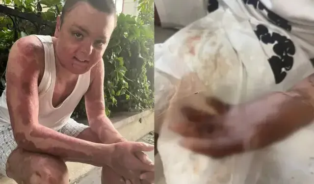 Kağıthane’de Kuaförde Çaydanlık Patladı: Çocuk Yaralandı