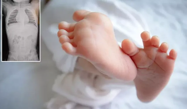 Maraş'ta 1 Yaşındaki Bebeğin Sırtından Zımba Teli Çıkarıldı