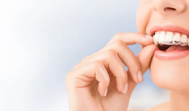 Modern Çağın Hızlı ve Etkili Ortodonti Çözümü