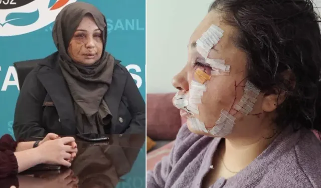 Eşine Şiddet Uygulayan Koruma Polisi Tutuklandı