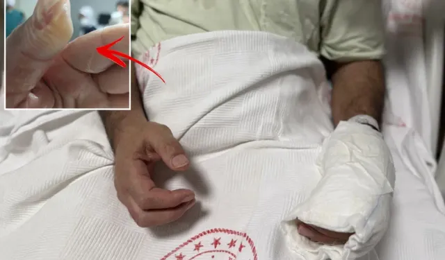 Sıcak Su Torbası Patladı, Vücudunun Yüzde 30’u Yandı