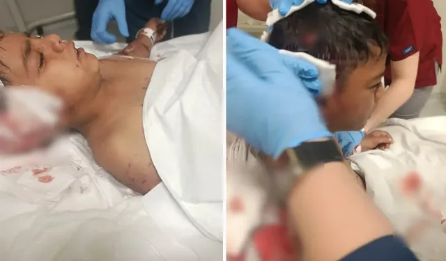 Altındağ’da Sokak Köpeği Saldırısı: 8 Yaşındaki Davut Yaralı