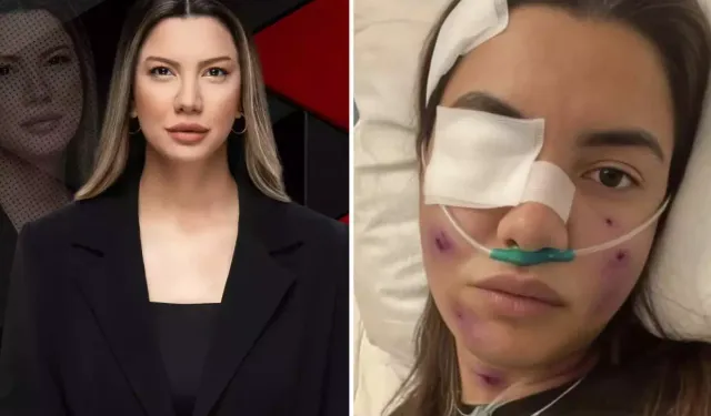 Fulya Öztürk İçin Sahte Kaza Görseli Tepkisi