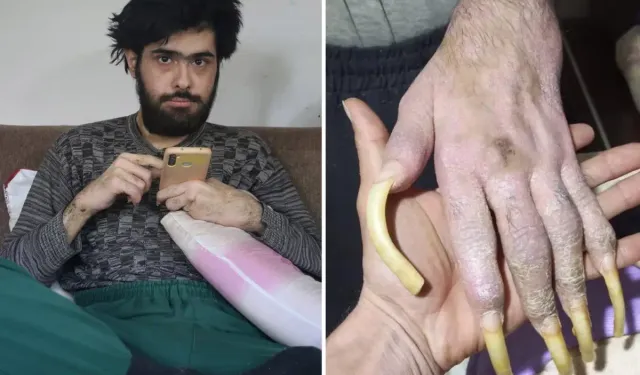 Deprem Sonrası Hayata Döndü Barış Özbay Yayıncılığa Başladı