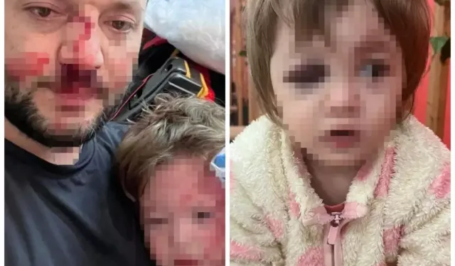 Çınarcık’ta Komşu Saldırısı Baba Ve Bebek Yaralı